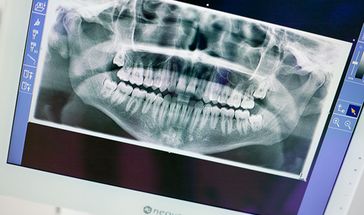 Ganzheitliche Diagnose beim Zahnarzt Lull 90766 Fürth/Nürnberg.